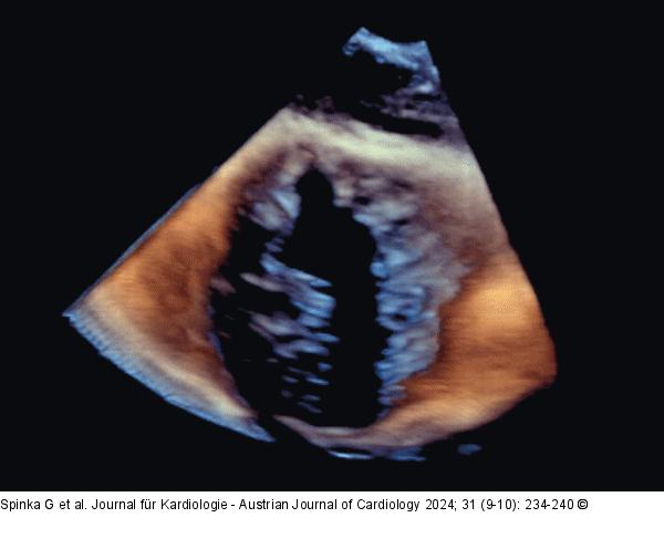 Trikuspidalklappenmorphologie