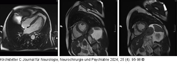 Herz-MRT