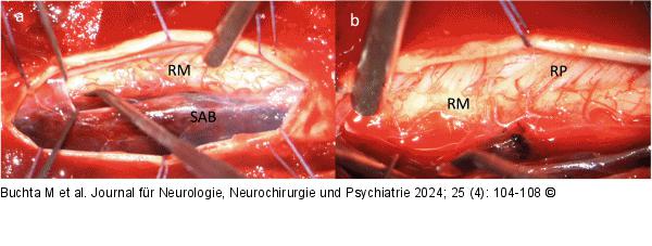 Intraoperative Bilder