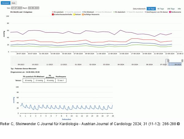 CardioMEMS™ HF-System - Medizinisches Monitoring