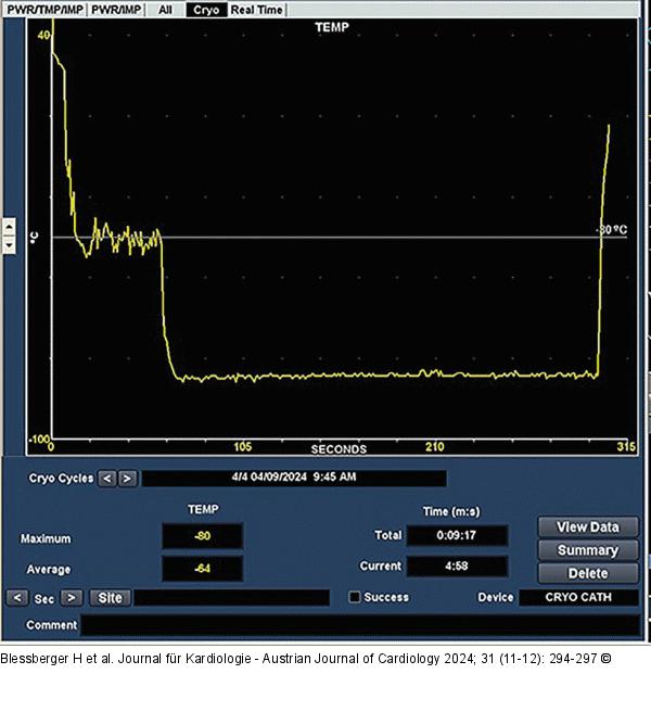 Kryo-Ablation