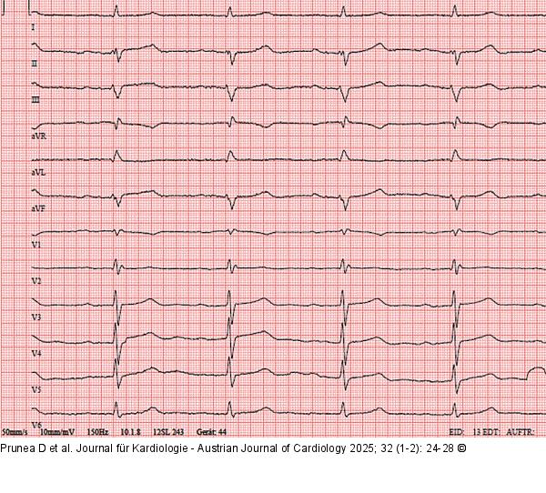 EKG bei der Aufnahme