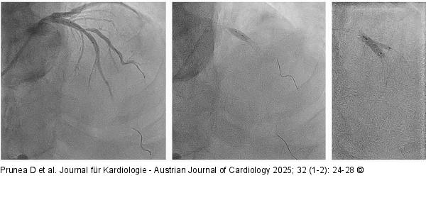 Angiographie