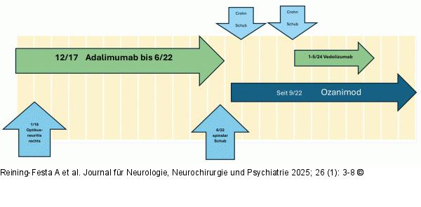 Zeitdiagramm