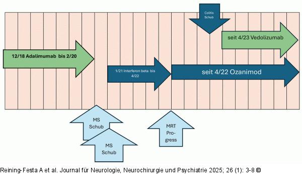 Zeitdiagramm
