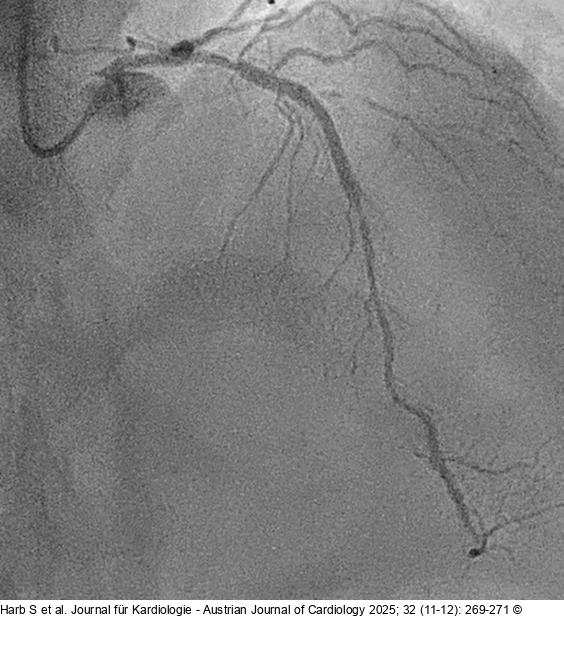 Angiography