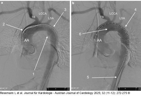 Angiographie