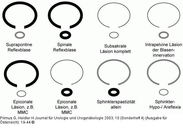 Blasenfunktionsstörung