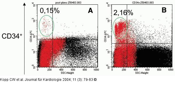 Endotheliale Progenitorzellen - CD34+