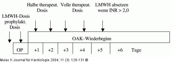 Orale Antikoagulation - Chirurgische Eingriffe