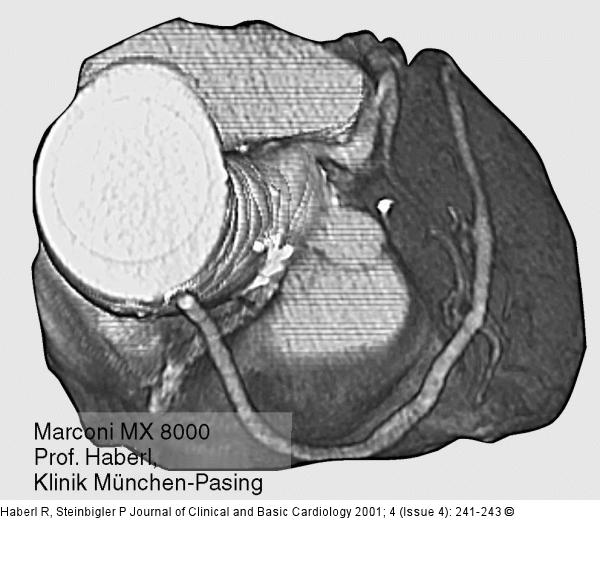 Koronarangiographie - Multislice CT