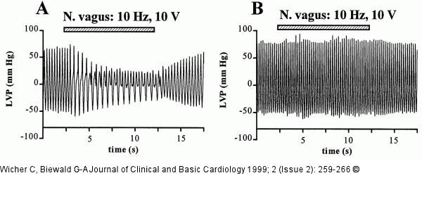 Angiotensin II - Vagusstimulation