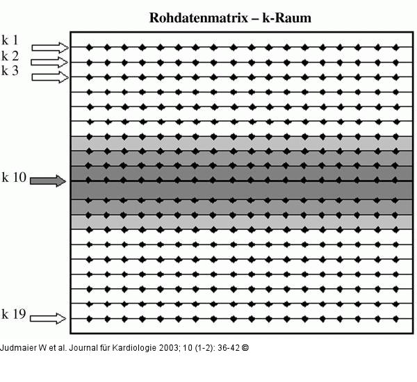 Rohdatensatz, k-Raum