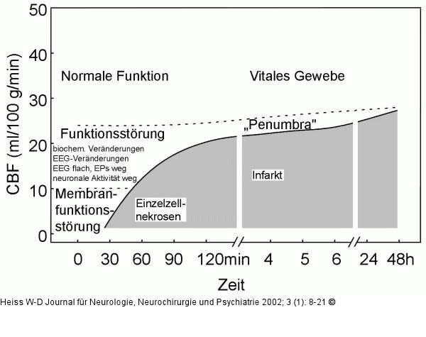 Gehirn - Perfusion