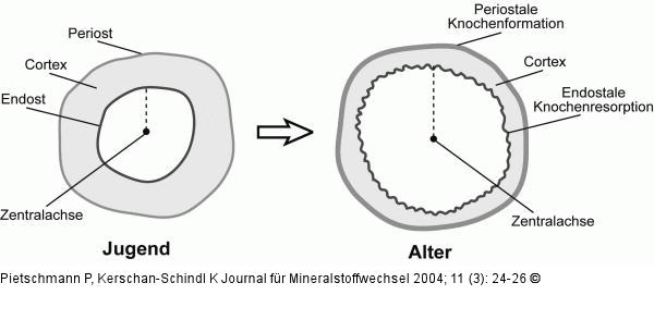 Knochengeometrie - Veränderung