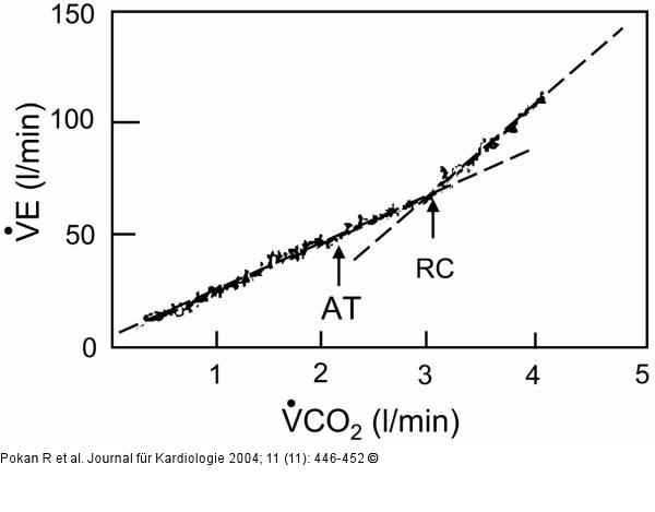 Anaerobic threshold - Respiratory compensation point