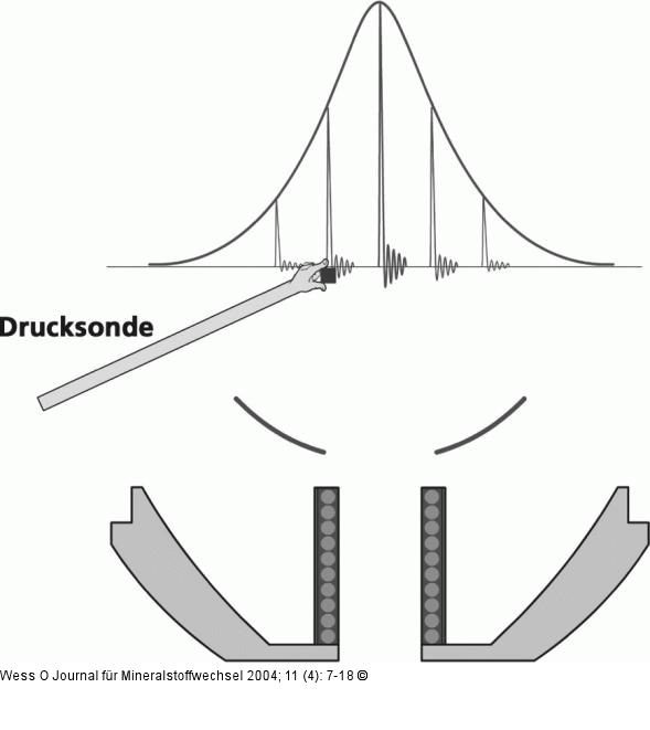 Stoßwellenfelder - Drucksonde