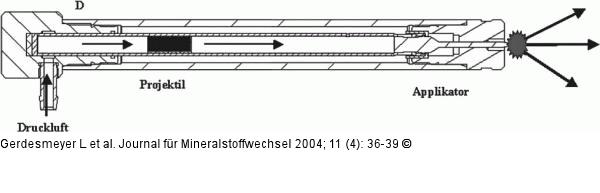 Ballistische Stoßwellenquelle