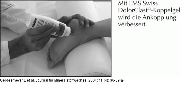 Radiale extrakorporale Stoßwellentherapie - Fersensporn