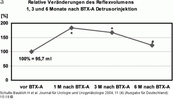 Urodynamische Reflexvolumen