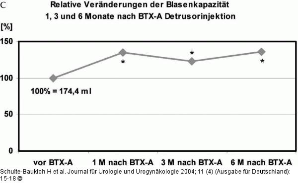 Urodynamische Reflexvolumen