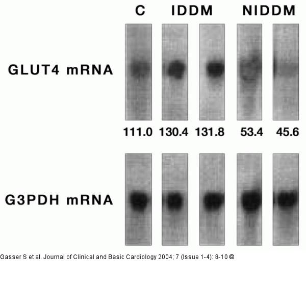 Northern Blot of RNA