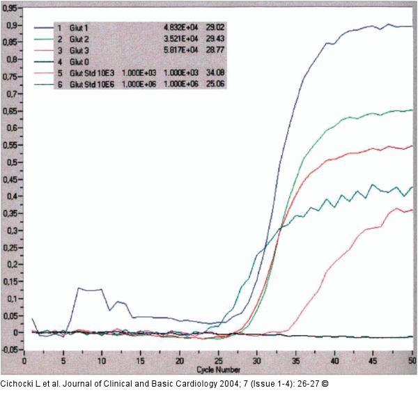 Real time PCR - GLUT4