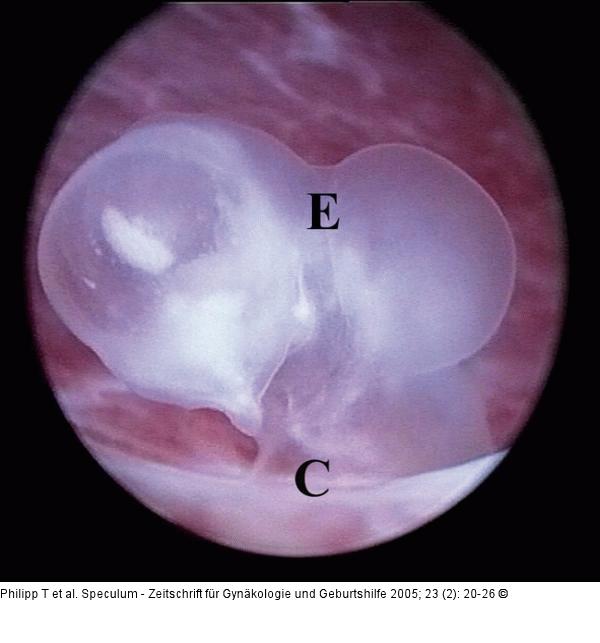 GD2-Embryo
