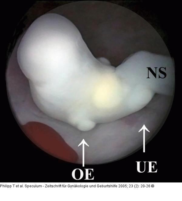 GD4-Embryo