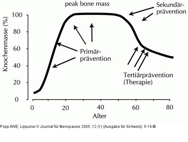 Osteoporose - Prävention - Therapie