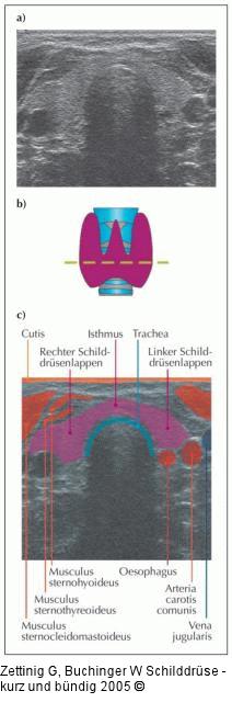 Schilddrüse - Sonographie