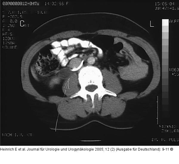 CT-Abdomen
