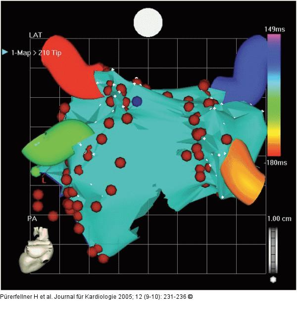 Elektroanatomisches Mapping