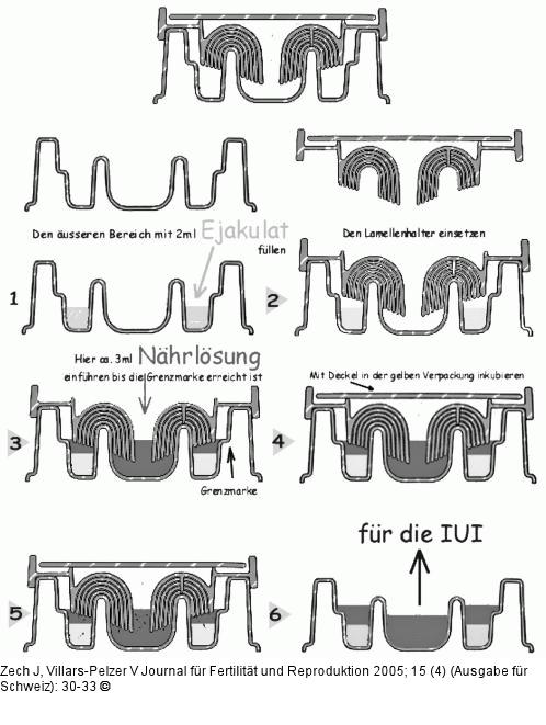 Zech-Selector(R)