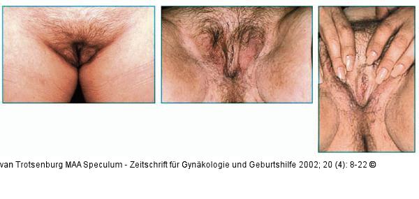 Transsexualität