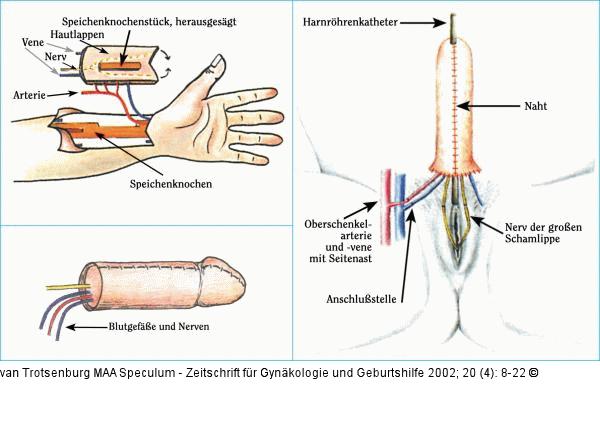 Transsexualität