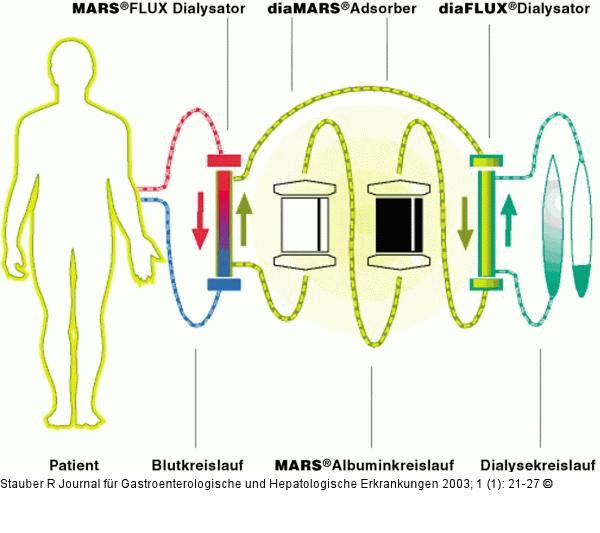 Leberunterstützungstherapie