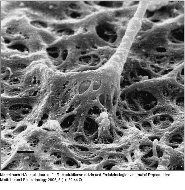 Spermatozoon - Zona pellucida