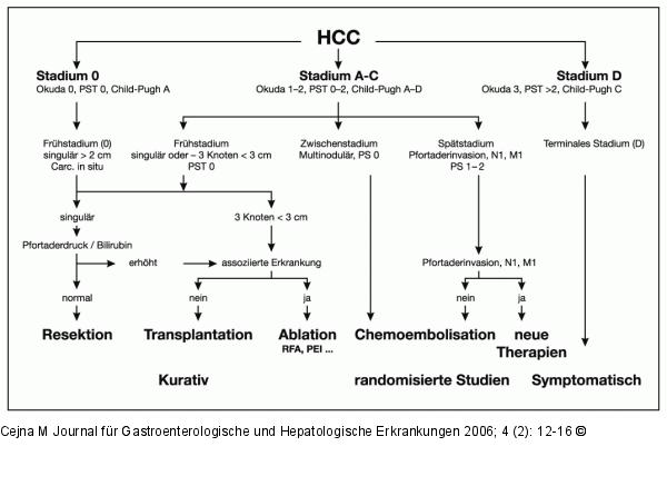 HCC - Therapiekonzept