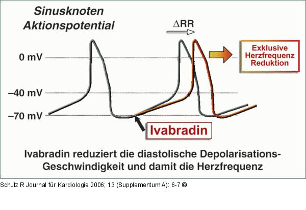 If-Kanal