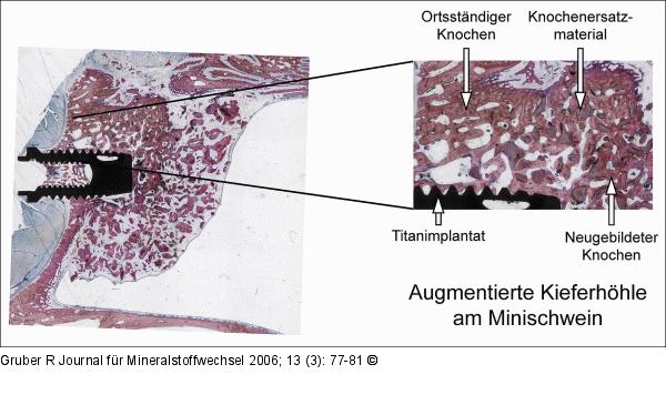 Augmentation