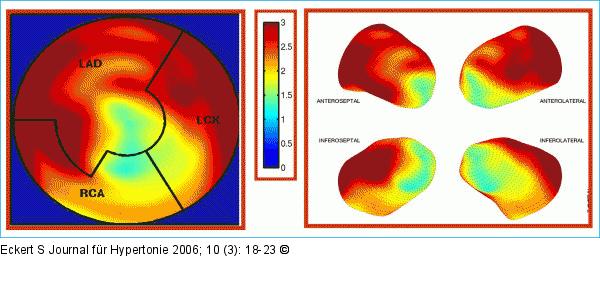 Ammoniak-Positronenemmissionstomographie