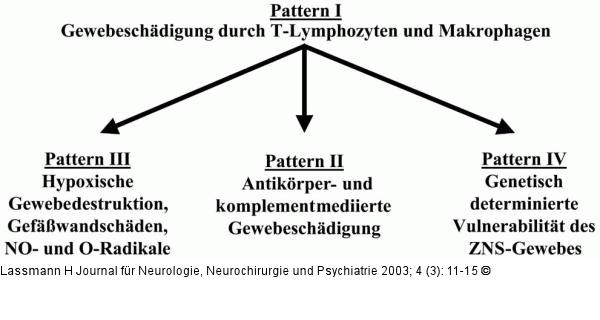 Multiple Sklerose - Gewebeschädigung