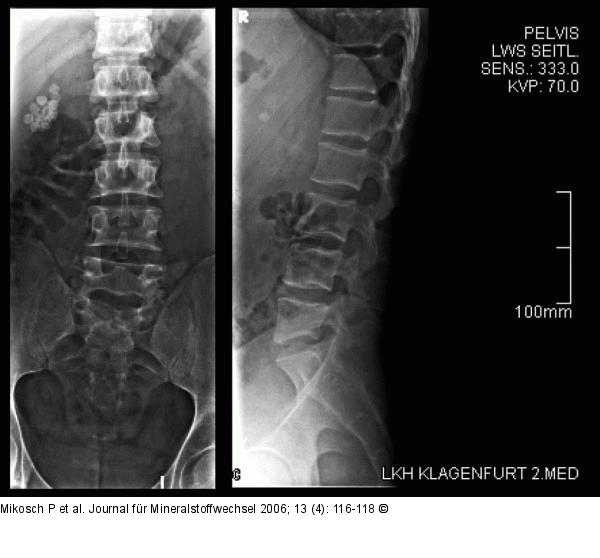 Osteologische Untersuchung
