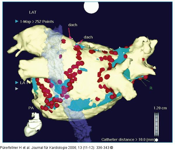 Elektroanatomie - CT-Anatomie