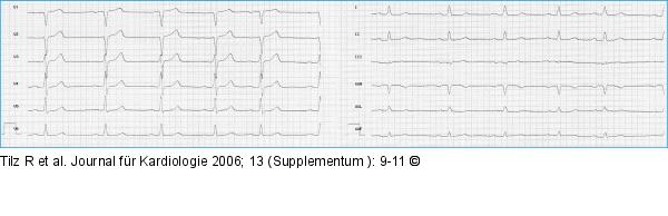 Ruhe-EKG