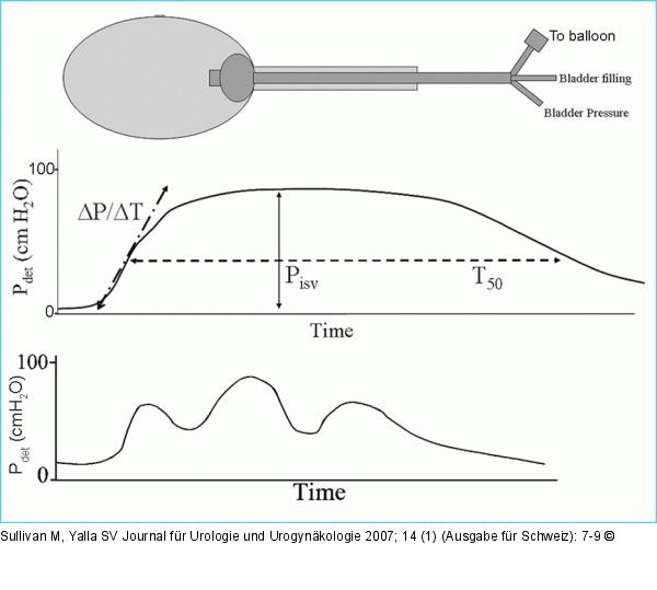 Isometric pressure