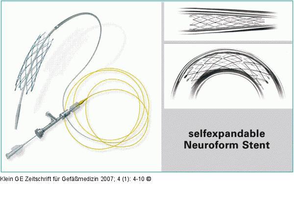 Mikroneurostent
