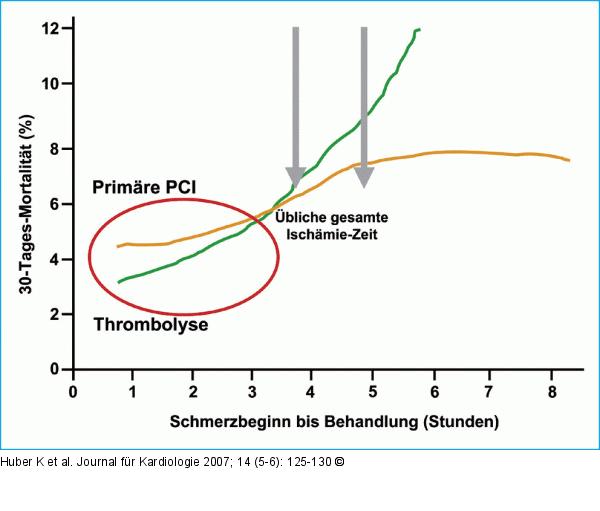 Primär-PCI - Thrombolyse