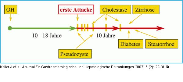 Chronische Pankreatitis